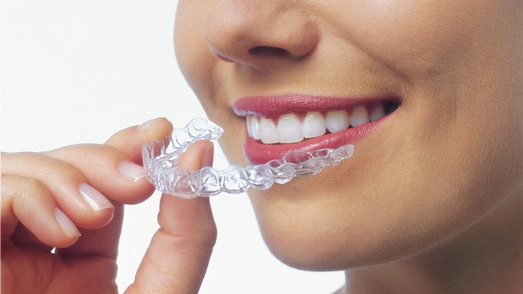 Invisalign
