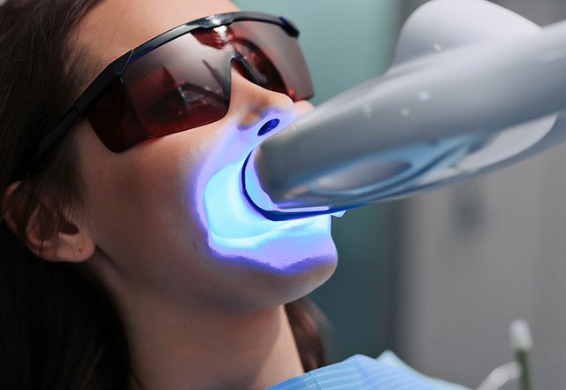 tooth whitening